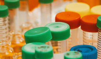close up of scientific test tubes and plastic bottles used in lab research