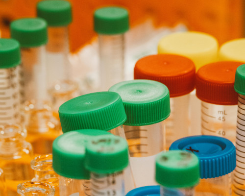 close up of scientific test tubes and plastic bottles used in lab research